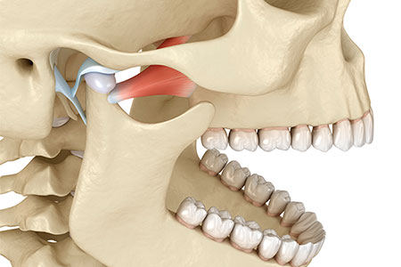 Uniodonto Votuporanga - Já teve a sensação de mandíbula travada? Ela também  pode ser um sinal da disfunção temporomandibular, a famosa DTM. A DTM é um  problema que acomete mais pessoas do