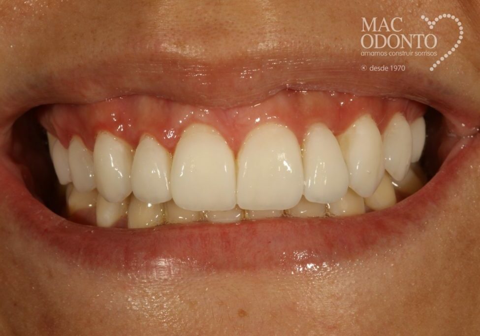 periodontia